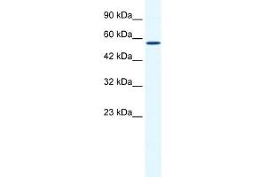 WB Suggested Anti-BTBD15 Antibody Titration:  0. (ZBTB44 抗体  (C-Term))