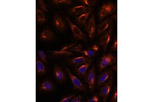 Immunofluorescence (IF) image for anti-Secretory Carrier Membrane Protein 2 (SCAMP2) (AA 1-152) antibody (ABIN7270188)
