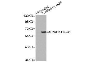 Western Blotting (WB) image for anti-3-phosphoinositide Dependent Protein Kinase-1 (PDPK1) (pSer241) antibody (ABIN1870500) (PDPK1 抗体  (pSer241))