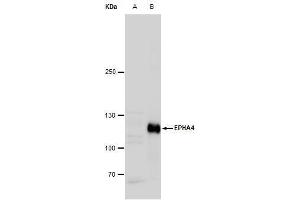 WB Image Eph receptor A4 antibody [N3C2], Internal detects Eph receptor A4 protein by western blot analysis. (EPH Receptor A4 抗体)