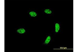Immunofluorescence of monoclonal antibody to GTF2A1L on HeLa cell. (GTF2A1L 抗体  (AA 251-348))