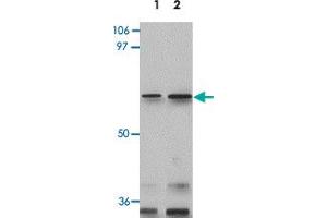 Western blot analysis of GLS2 in rat kidney tissue lysate with GLS2 polyclonal antibody  at 0. (GLS2 抗体  (Internal Region))