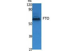 Western Blotting (WB) image for anti-Fat Mass and Obesity-Associated (FTO) (N-Term) antibody (ABIN3178067) (FTO 抗体  (N-Term))