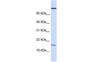 GABARAP antibody used at 1 ug/ml to detect target protein. (GABARAP 抗体)