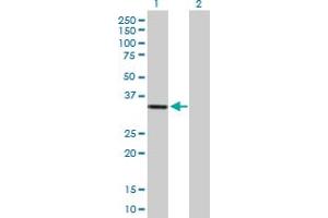 Western Blot analysis of HSA9761 expression in transfected 293T cell line by HSA9761 MaxPab polyclonal antibody. (DIMT1 抗体  (AA 1-313))