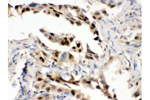 Immunohistochemistry (Paraffin-embedded Sections) (IHC (p)) image for anti-Heat Shock 70kDa Protein 1A (HSPA1A) (AA 559-596), (C-Term) antibody (ABIN3043849) (HSP70 1A 抗体  (C-Term))