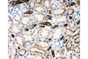 IHC-F testing of NKCC2 antibody and rat kidney tissue (SLC12A1 抗体  (N-Term))