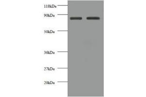 Western blot All lanes: CDH12 antibody at 2 μg/mL Lane 1: EC109 whole cell lysate Lane 2: 293T whole cell lysate Secondary Goat polyclonal to rabbit IgG at 1/10000 dilution Predicted band size: 89, 85 kDa Observed band size: 85 kDa (Cadherin 12 抗体  (AA 56-605))