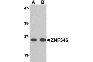 Western blot analysis of TRIP6 in EL4 cell lysate with TRIP6 antibody at 1 μg/ml. (ZNF346 抗体  (N-Term))