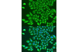 Immunofluorescence analysis of U2OS cells using TUBGCP3 antibody (ABIN1875232) at dilution of 1:100. (TUBGCP3 抗体)