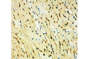 IHC-P: FABP5 antibody testing of mouse heart (FABP5 抗体  (AA 10-23))
