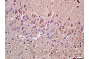 Formalin-fixed and paraffin embedded rat brain labeled with Anti-VAV3 Polyclonal Antibody, Unconjugated (ABIN706421) at 1:200 followed by conjugation to the secondary antibody and DAB staining (VAV3 抗体  (AA 701-800))