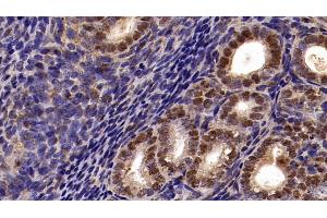 Immunohistochemistry (IHC) image for anti-Chromobox Homolog 3 (CBX3) (AA 1-183) antibody (ABIN7434851)