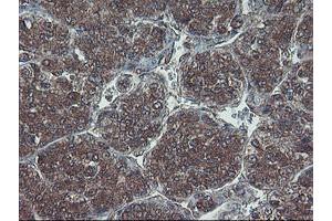 Image no. 3 for anti-Haloacid Dehalogenase-Like Hydrolase Domain Containing 1 (HDHD1) antibody (ABIN1498623) (HDHD1 抗体)