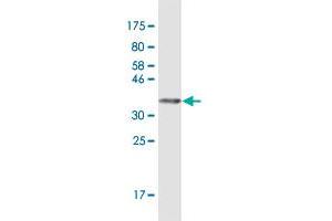 Western Blot detection against Immunogen (38. (TLR5 抗体  (AA 517-634))