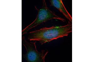 Immunofluorescent analysis of 4 % paraformaldehyde-fixed, 0. (SGK1 抗体  (Ser78))