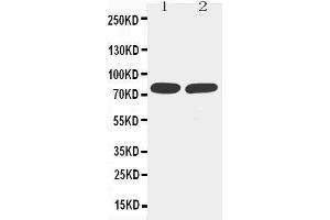 Anti-TNF Receptor II antibody, Western blotting Lane 1: MM453 Cell Lysate Lane 2: JURKAT Cell Lysate