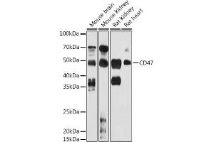 Western blot analysis of extracts of various cell lines, using CD47 antibody (ABIN6127604, ABIN6138199, ABIN6138201 and ABIN6223104) at 1:1000 dilution. (CD47 抗体  (AA 20-140))