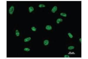 Immunostaining analysis in HeLa cells. (DDX39 抗体)