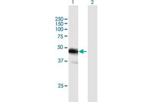 Western Blot analysis of FBLIM1 expression in transfected 293T cell line by FBLIM1 MaxPab polyclonal antibody. (FBLIM1 抗体  (AA 1-373))