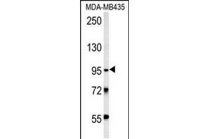 Western blot analysis in MDA-MB435 cell line lysates (15ug/lane). (TRHDE 抗体  (C-Term))