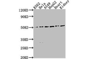 Western Blot Positive WB detected in: K562 whole cell lysate, HeLa whole cell lysate, A549 whole cell lysate, HepG2 whole cell lysate, Mouse heart tissue, Mouse kidney tissue All lanes: ENPP7 antibody at 1:2000 Secondary Goat polyclonal to rabbit IgG at 1/50000 dilution Predicted band size: 52 kDa Observed band size: 52 kDa (ENPP7 抗体  (AA 22-216))