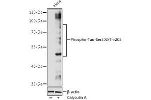 Western blot analysis of extracts of Hela cells, using Phospho-Tau-Ser202/Thr205 antibody (ABIN7268525) at 1:1000 dilution. (MAPT 抗体  (pSer202, pThr205))