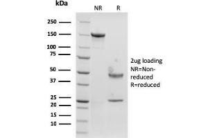 SDS-PAGE Analysis Purified Langerin Recombinant Mouse Monoclonal Antibody (rLGRN/1821). (Recombinant CD207 抗体  (AA 74-213))