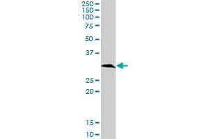 KHK MaxPab rabbit polyclonal antibody. (Ketohexokinase 抗体  (AA 1-298))