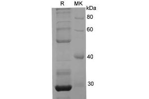 Western Blotting (WB) image for DNA (Cytosine-5)-Methyltransferase 1 (DNMT1) protein (His tag) (ABIN7321287) (DNMT1 Protein (His tag))