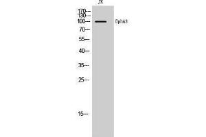 Western Blotting (WB) image for anti-EPH Receptor A3 (EPHA3) (Ser346) antibody (ABIN3184502) (EPH Receptor A3 抗体  (Ser346))