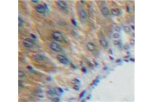 Used in DAB staining on fromalin fixed paraffin-embedded Liver tissue (SHBG 抗体  (AA 224-388))