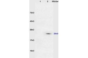 Lane 1: mouse lung lysates Lane 2: mouse intestine lysates probed with Anti DARPP32 Polyclonal Antibody, Unconjugated (ABIN680323) at 1:200 in 4 °C. (DARPP32 抗体  (AA 51-150))