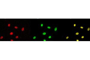 Immunofluorescence (IF) image for anti-Tumor Protein P53 (TP53) (pSer315) antibody (ABIN3201006) (p53 抗体  (pSer315))
