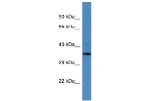 Western Blotting (WB) image for anti-MLF1 Interacting Protein (MLF1IP) (N-Term) antibody (ABIN2788059) (MLF1IP 抗体  (N-Term))
