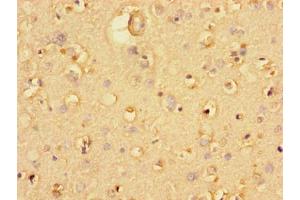 Immunohistochemistry of paraffin-embedded human brain tissue using ABIN7174530 at dilution of 1:100 (UBA6 抗体  (AA 1-44))