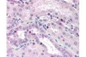 Immunohistochemistry (IHC) image for anti-CCAAT/enhancer Binding Protein (C/EBP), beta (CEBPB) (AA 39 - 78) antibody (ABIN2469775)