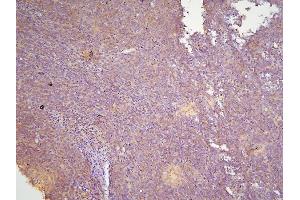 IHC analysis of HOOK3 using anti-HOOK3 antibody (ABIN6719547).