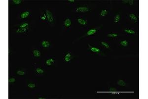 Immunofluorescence of purified MaxPab antibody to LHX4 on HeLa cell. (LHX4 抗体  (AA 1-390))