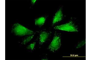 Immunofluorescence of monoclonal antibody to SLC25A13 on HepG2 cell. (slc25a13 抗体  (AA 2-80))