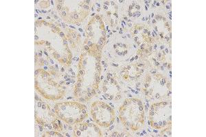 Immunohistochemistry (IHC) image for anti-Potassium Intermediate/small Conductance Calcium-Activated Channel, Subfamily N, Member 4 (KCNN4) antibody (ABIN1873386)