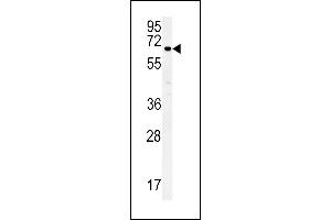 Western Blotting (WB) image for anti-Epithelial Splicing Regulatory Protein 1 (ESRP1) (AA 182-211) antibody (ABIN652121)