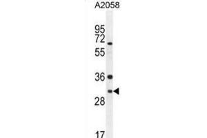 Western Blotting (WB) image for anti-ARV1 Homolog (ARV1) antibody (ABIN2995757) (ARV1 抗体)