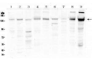 Western blot analysis of HDAC5 using anti-HDAC5 antibody (ABIN6719321). (HDAC5 抗体  (AA 102-197))