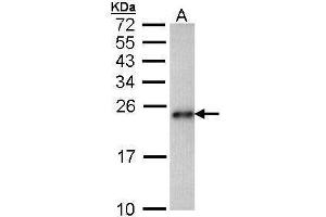 WB Image Sample (30 ug of whole cell lysate) A: Hep G2 , 15% SDS PAGE antibody diluted at 1:1000 (CARHSP1 抗体)