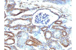 Immunohistochemistry (IHC) image for anti-Spectrin, Beta, Non-erythrocytic 2 (SPTBN2) (AA 356-475) antibody (ABIN6940653)