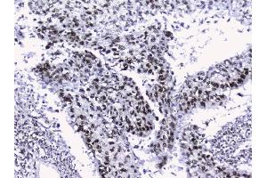 IHC analysis of nmt55/p54nrb using anti-nmt55/p54nrb antibody (ABIN3044530). (NONO 抗体  (N-Term))