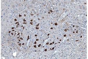 IHC analysis of MAP3K8 using anti-MAP3K8 antibody (ABIN4886663). (MAP3K8 抗体  (AA 9-193))