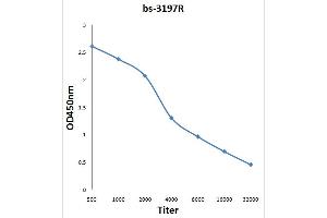 Antigen: 0. (IRS1 抗体  (pSer1101))