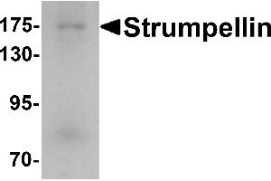 Western blot analysis of Strumpellin in human ovary tissue lysate with Strumpellin antibody at 1 µg/mL. (Strumpellin 抗体  (C-Term))